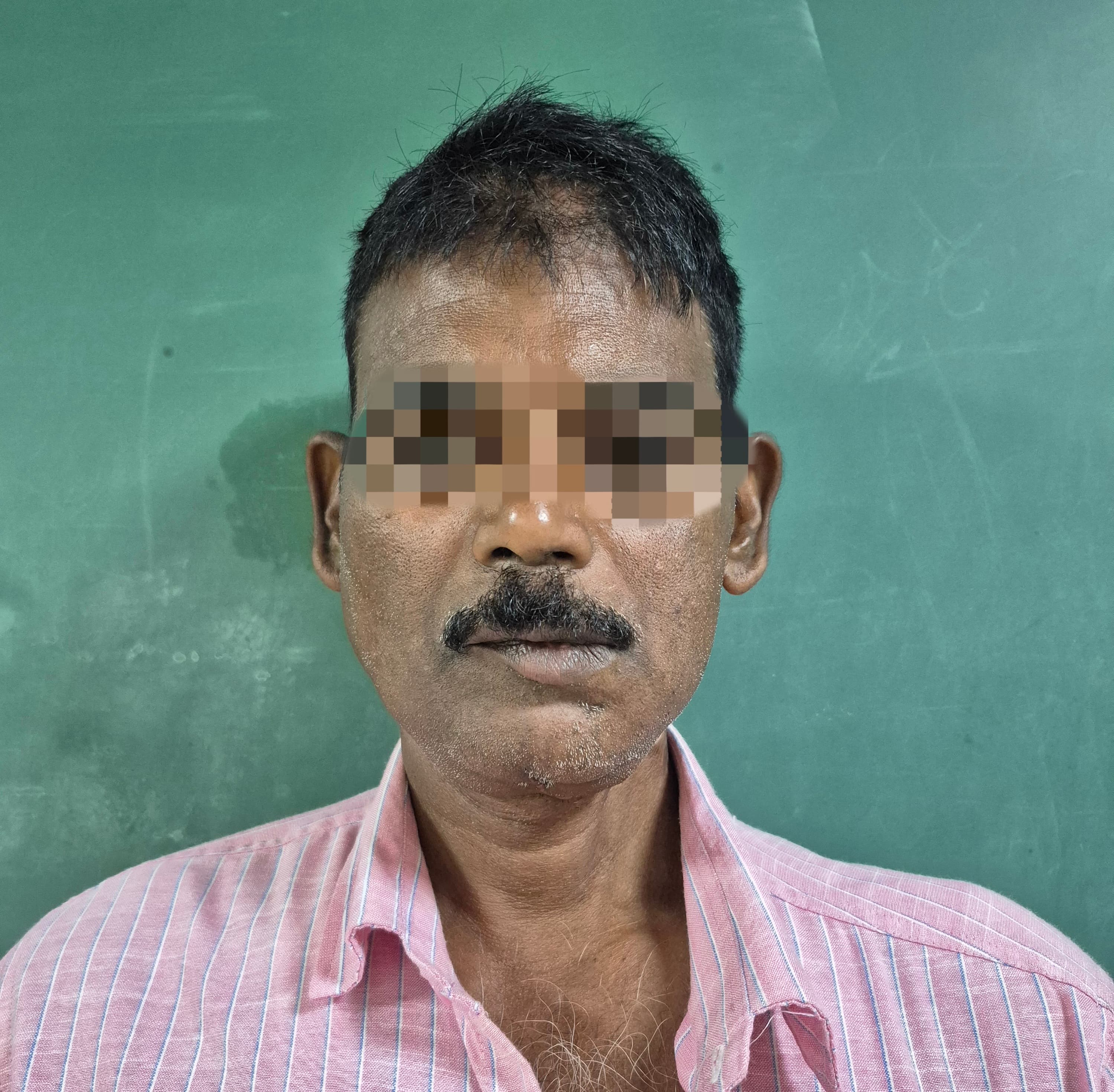 Oral Cancer result 1
